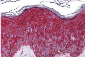 Human Skin: Formalin-Fixed, Paraffin-Embedded (FFPE) (KREMEN1 antibody  (AA 71-120))