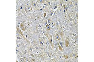 Immunohistochemistry of paraffin-embedded rat brain using PLCG1 Antibody. (Phospholipase C gamma 1 antibody)