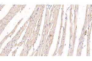 Detection of KNT1 in Rat Heart Tissue using Monoclonal Antibody to T-Kininogen 1 (KNT1) (KNG1 antibody  (AA 378-430))