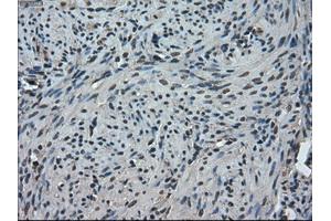 Immunohistochemical staining of paraffin-embedded Ovary tissue using anti-TMEM100mouse monoclonal antibody. (TMEM100 antibody)