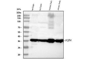 Western blot analysis of Aquaporin 4 using anti-Aquaporin 4 antibody (ABIN3043789). (Aquaporin 4 antibody  (C-Term))
