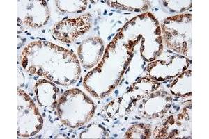 Immunohistochemical staining of paraffin-embedded Kidney tissue using anti-PLEK mouse monoclonal antibody. (Pleckstrin antibody)