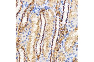 Immunohistochemistry of paraffin-embedded Rat kidney using Mitofusin 2 Rabbit pAb (ABIN6133825, ABIN6143800, ABIN6143803 and ABIN6216518) at dilution of 1:100 (40x lens). (MFN2 antibody  (AA 500-600))