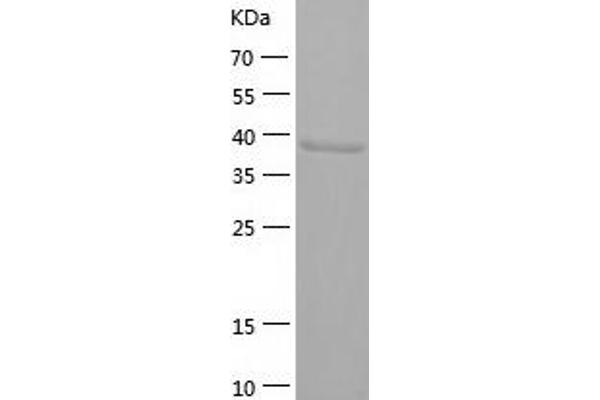 ADH1C Protein (AA 1-375) (His tag)