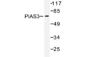 Image no. 1 for anti-Protein Inhibitor of Activated STAT, 3 (PIAS3) antibody (ABIN271953) (PIAS3 antibody)