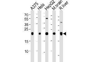 Western blot analysis of lysates from A375, Hela, HepG2 cell line, mouse brain and rat liver tissue lysate(from left to right), using ITPA Antibody at 1:1000 at each lane.