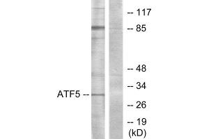 Western blot analysis of extracts from Jurkat cells, using ATF5 antibody. (ATF5 antibody  (C-Term))