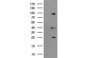 Image no. 1 for anti-Ubiquitin Specific Peptidase 16 (USP16) (AA 137-466) antibody (ABIN1490917) (USP16 antibody  (AA 137-466))