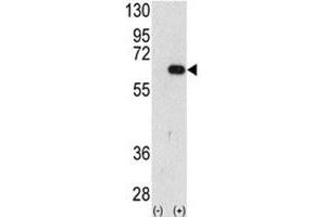 Western Blotting (WB) image for anti-Autocrine Motility Factor Receptor (AMFR) (AA 571-601) antibody (ABIN3030083)