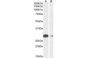 ABIN6391392 (1µg/ml) staining of Mouse (A) and Rat (B) Lung lysate (35µg protein in RIPA buffer). (ASCL1 antibody  (AA 79-91))