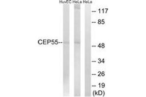 Western blot analysis of extracts from HeLa/HuvEc cells, using CEP55 Antibody. (CEP55 antibody  (AA 81-130))