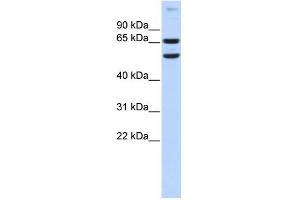 WB Suggested Anti-RELB Antibody Titration:  0. (RELB antibody  (N-Term))