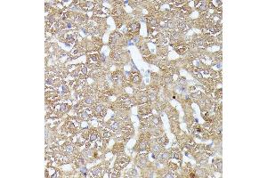 Immunohistochemistry of paraffin-embedded rat liver using CDK5R antibody (ABIN7266235) at dilution of 1:100 (40x lens). (CDK5RAP1 antibody  (AA 1-350))