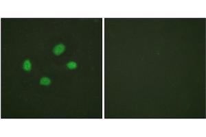Immunofluorescence staining of methanol-fixed HeLa cells using Chk2 (Phospho-Thr383) Antibody. (CHEK2 antibody  (pThr383))