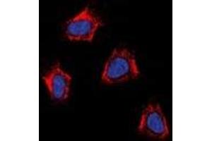 Immunofluorescence (IF) image for anti-Angiotensin II Receptor, Type 1a (AGTR1a) antibody (ABIN7303410)