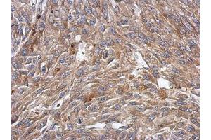 Image no. 1 for anti-BTB (POZ) Domain-Containing Protein KCTD4 (KCTD4) (AA 1-225) antibody (ABIN1499011) (KCTD4 antibody  (AA 1-225))
