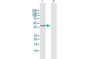 Western Blot analysis of DHH expression in transfected 293T cell line by DHH MaxPab polyclonal antibody. (desert Hedgehog antibody  (AA 1-396))
