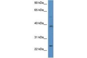 Image no. 1 for anti-Acyl-CoA Thioesterase 9 (Acot9) (AA 356-405) antibody (ABIN6746915) (ACOT9 antibody  (AA 356-405))