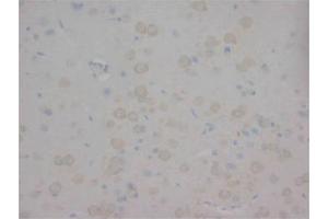 Immunohistochemistry on Paraffin Sections of Rat brain using AP23320PU-N CHRNA1 antibody. (CHRNA1 antibody  (N-Term, Subunit alpha))