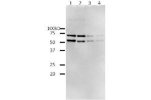 Western Blotting (WB) image for HIV-1 Reverse Transcriptase (HIV1RT) (Active) protein (ABIN2452197) (HIV1RT Protein)