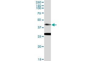 Immunoprecipitation of OTX1 transfected lysate using anti-OTX1 MaxPab rabbit polyclonal antibody and Protein A Magnetic Bead , and immunoblotted with OTX1 monoclonal antibody (M01), clone 1F2 . (OTX1 antibody  (AA 1-354))