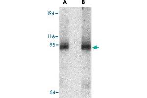Western blot analysis of CD180 in human spleen tissue lysate with CD180 polyclonal antibody  at (A) 0. (CD180 antibody  (Internal Region))