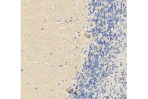 anti-LIM Homeobox 1 (LHX1) (AA 1-317) antibody