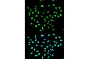 Immunofluorescence (IF) image for anti-Heterogeneous Nuclear Ribonucleoprotein K (HNRNPK) (AA 1-280) antibody (ABIN3022414)