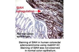 Image no. 2 for anti-Siah E3 Ubiquitin Protein Ligase 2 (SIAH2) (AA 1-100), (N-Term) antibody (ABIN363296) (SIAH2 antibody  (N-Term))