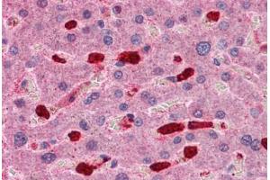 Human Liver: Formalin-Fixed, Paraffin-Embedded (FFPE) (ARHGAP18 antibody  (C-Term))