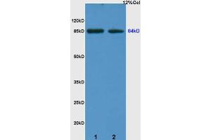 L1 human colon carcinoma lysates L2 rat kidney lysates probed with Anti ARHGAP24 Polyclonal Antibody, Unconjugated (ABIN714716) at 1:200 overnight at 4 °C.