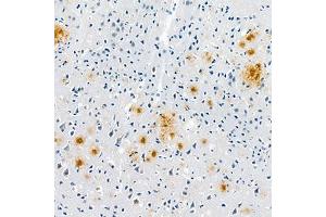 Immunohistochemistry analysis of paraffin embedded mouse Alzheimer',s brainusing Aβ40 (ABIN7073042) at dilution of 1:400 (Abeta 1-40 antibody)