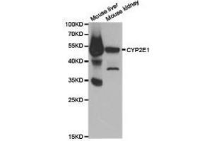Western Blotting (WB) image for anti-Cytochrome P450, Family 2, Subfamily E, Polypeptide 1 (CYP2E1) antibody (ABIN1872172) (CYP2E1 antibody)