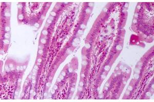 Anti-CTGF antibody IHC staining of human small intestine.
