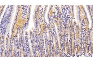 Detection of NME1 in Mouse Small intestine Tissue using Polyclonal Antibody to Non Metastatic Cells 1, Protein NM23A Expressed In (NME1) (NME1 antibody  (AA 6-147))