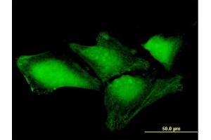 Immunofluorescence of purified MaxPab antibody to THAP4 on HeLa cell. (THAP4 antibody  (AA 1-577))