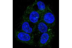 Immunofluorescent analysis of Hepg2 cells, using ATG9A Antibody. (Recombinant ATG9A antibody)