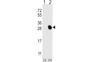Western Blotting (WB) image for anti-Osteocalcin (BGLAP) antibody (ABIN3001265) (Osteocalcin antibody)