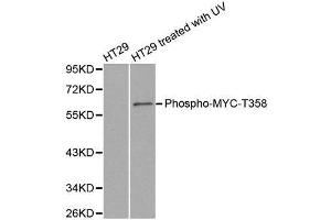Western blot analysis of extracts from HT29 cells untreated or treated with UV, using phospho-MYC-T358 antibody. (c-MYC antibody  (pThr358))