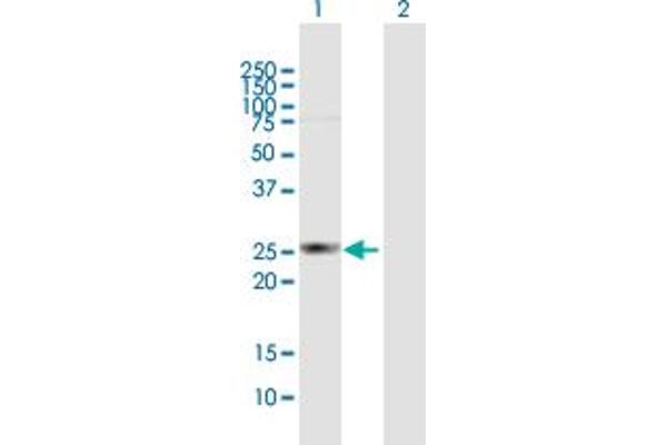 HDHD3 antibody  (AA 1-251)
