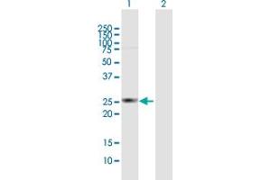 Western Blot analysis of HDHD3 expression in transfected 293T cell line by HDHD3 MaxPab polyclonal antibody. (HDHD3 antibody  (AA 1-251))