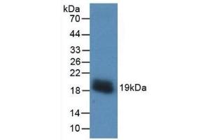 Detection of Recombinant VEGFA, Human using Monoclonal Antibody to Vascular Endothelial Growth Factor A (VEGFA) (VEGFA antibody  (AA 28-147))