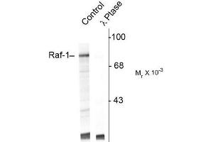 Image no. 1 for anti-V-Raf-1 Murine Leukemia Viral Oncogene Homolog 1 (RAF1) (pSer301) antibody (ABIN372711)
