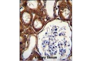 GPX3 Antibody (Center) (ABIN650617 and ABIN2844787) immunohistochemistry analysis in formalin fixed and paraffin embedded human kidney tissue followed by peroxidase conjugation of the secondary antibody and DAB staining. (GPX3 antibody  (AA 93-123))