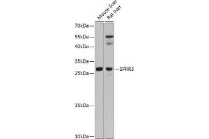 Western blot analysis of extracts of various cell lines, using SPRR3 antibody (ABIN6130714, ABIN6148386, ABIN6148387 and ABIN6215609) at 1:3000 dilution.