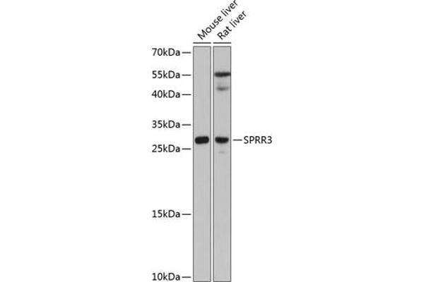 SPRR3 anticorps  (AA 1-70)