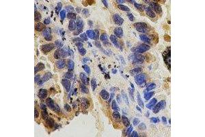 Immunohistochemistry (IHC) image for anti-Integrin beta 1 (ITGB1) (C-Term) antibody (ABIN7303982)