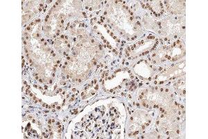 ABIN6279881 at 1/200 staining human kidney tissue sections by IHC-P. (TCEAL8 antibody  (Internal Region))