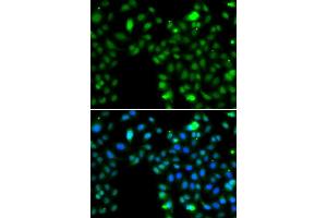 Immunofluorescence analysis of MCF7 cell using ING5 antibody. (ING5 antibody)