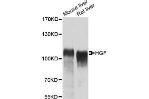 Western blot analysis of extracts of various cell lines, using HGF antibody (ABIN1872965) at 1:400 dilution. (HGF antibody)